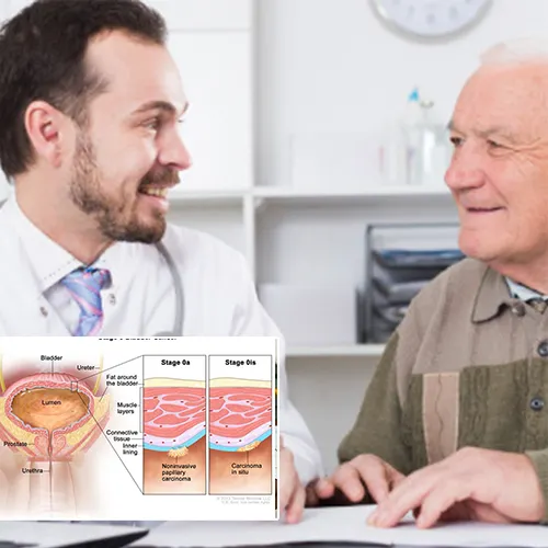 Understanding Penile Implant Surgery: A Comprehensive Overview by   Virtua Center for Surgery
